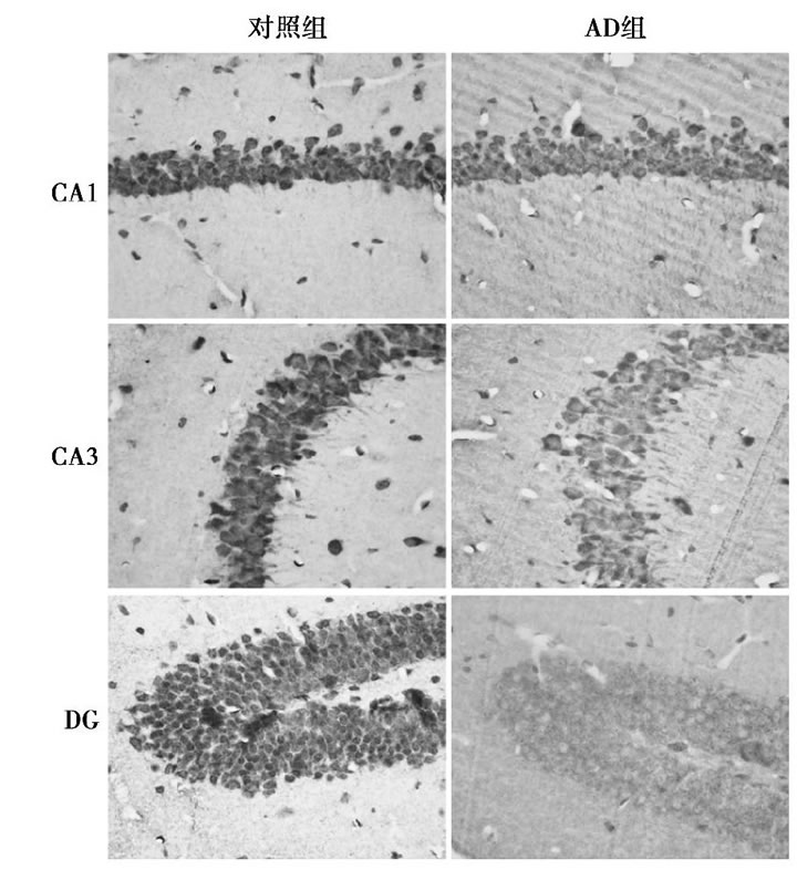 圖2 兩組小鼠各區(qū)Bcl2表達免疫組化結果